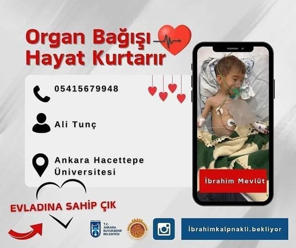 Doğuştan Kalp Rahatsızlığı Olan Bebek Kalp Nakli Bekliyor