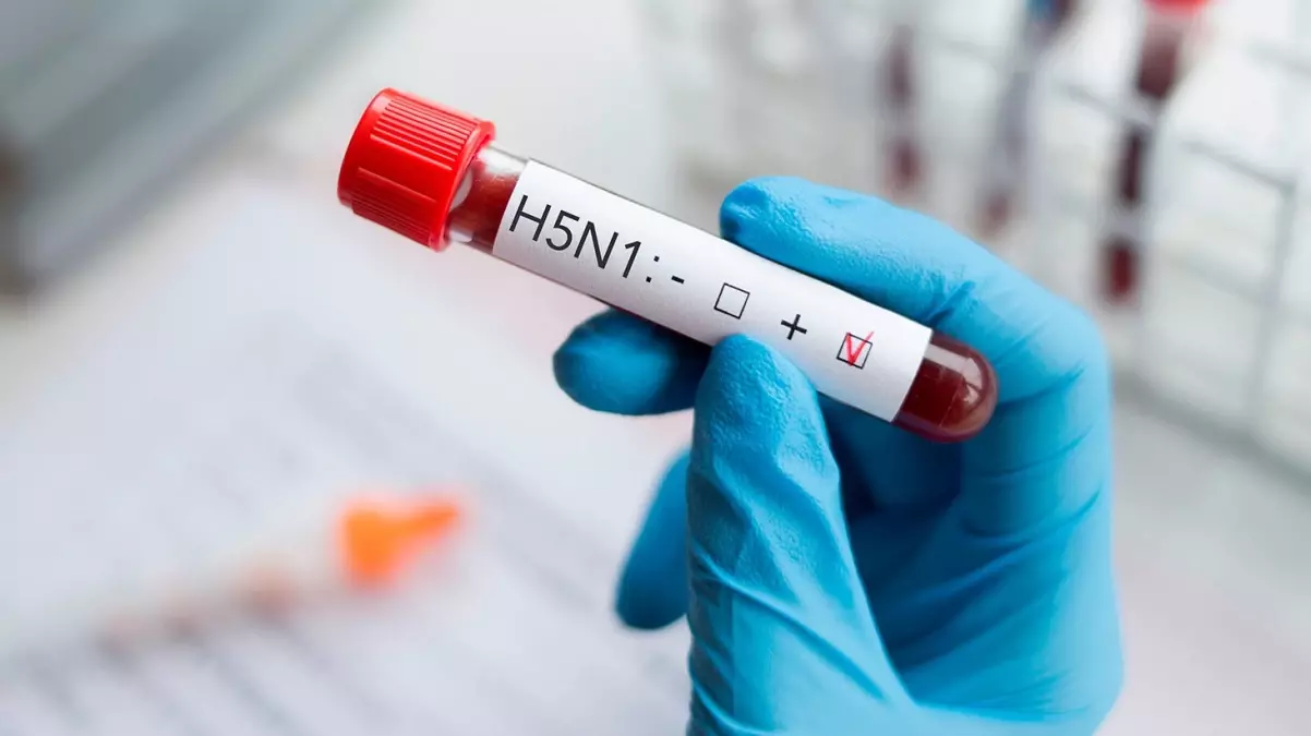 İstanbul'daki HIV Pozitif Çocuk Vakalarında Şok Edici Artış İddiası